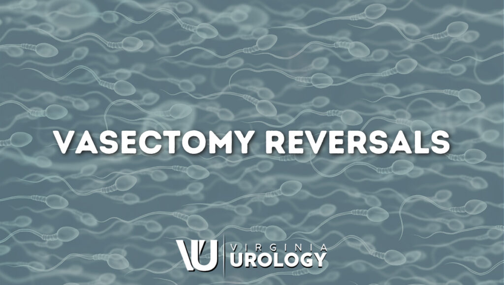 Vasectomy Reversals